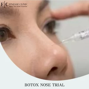 Botox Nose Trial
