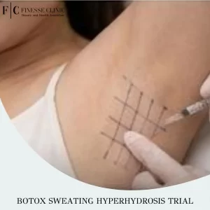 Botox Sweating Hyperhydrosis Trial