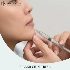 Filler Chin Trial