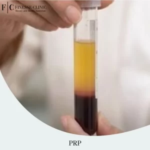 Prp Trial